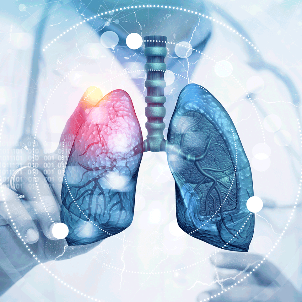 ENFERMEDADES BRONCOPULMONARES