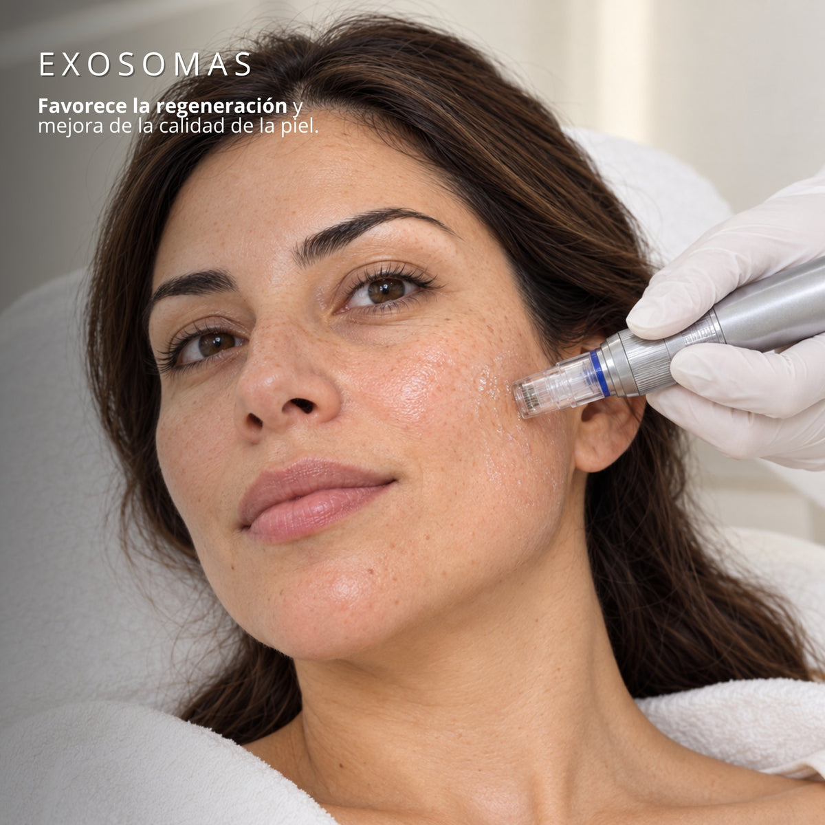 Aplicación de exosomas ASCE plus en el rostro con dermapen en Clínica Hiperbárica