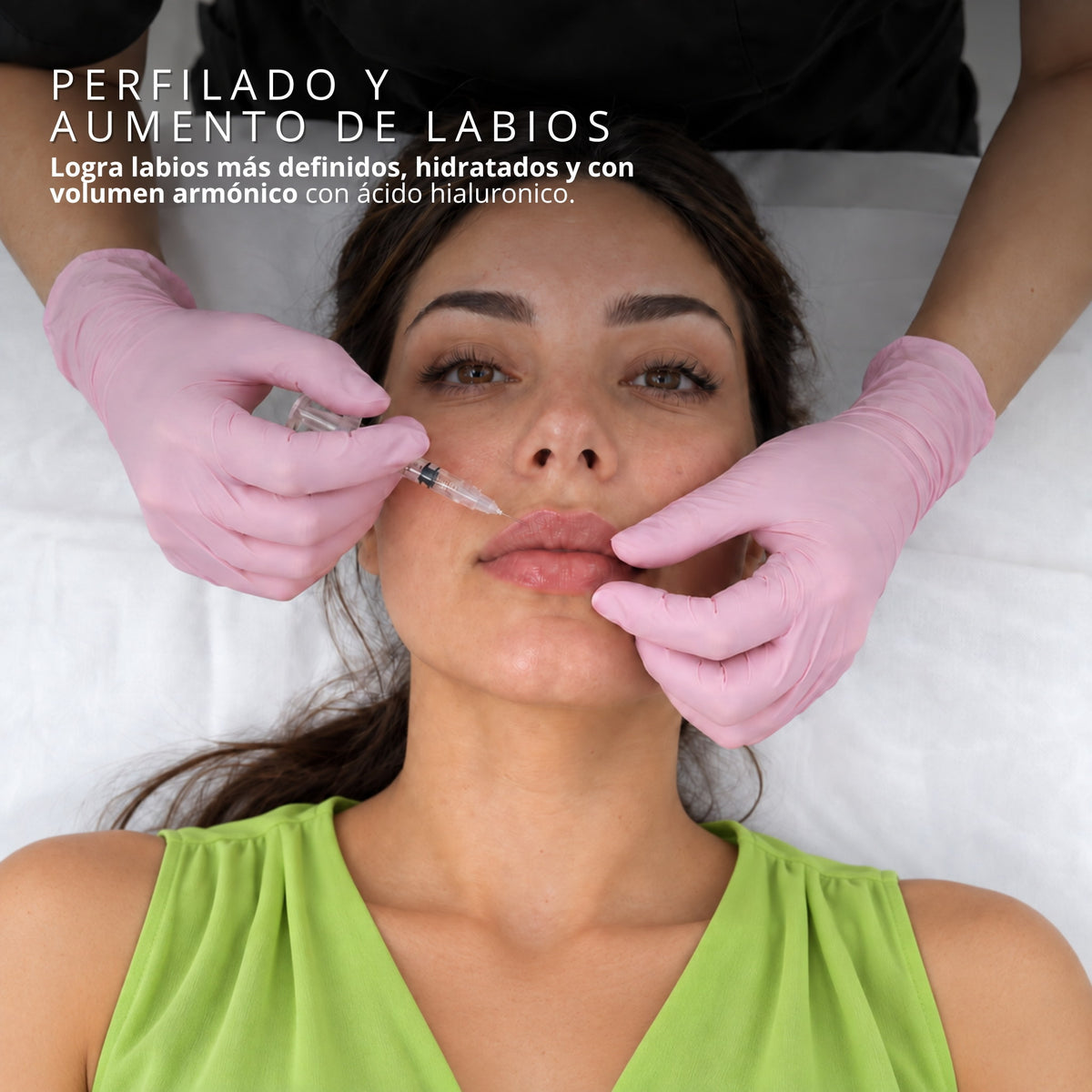 Aplicación de ácido hialurónico para perfilado y aumento de labios