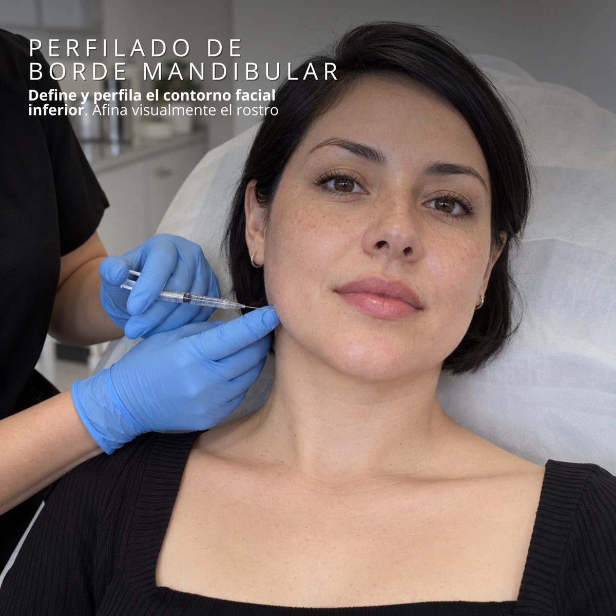 Aplicación de ácido hialurónico para perfilado del borde mandibular
