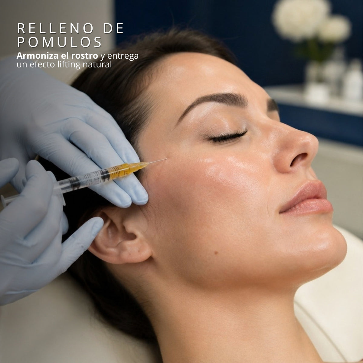 Aplicación de relleno de pómulos con ácido hialurónico en cabina clínica